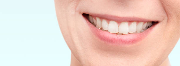 istock Smiling woman mouth with white teeth 1174414074