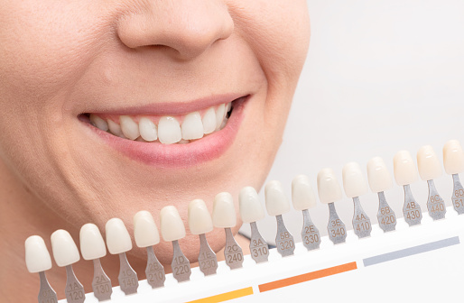 Woman smile with healthy teeth whitening. Dental care concept.