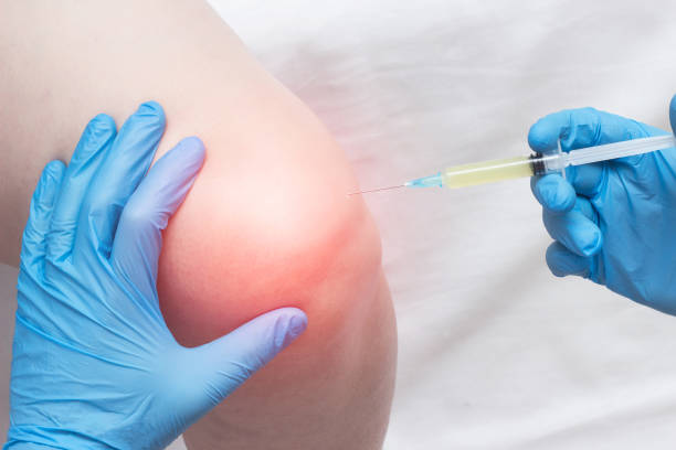 The doctor injects plasma into a sore, inflamed female knee for arthrosis and arthritis, plasma-lifting, close-up, medical, professional The doctor injects plasma into a sore, inflamed female knee for arthrosis and arthritis, plasma-lifting, close-up, medical, biotechnology cartilage photos stock pictures, royalty-free photos & images