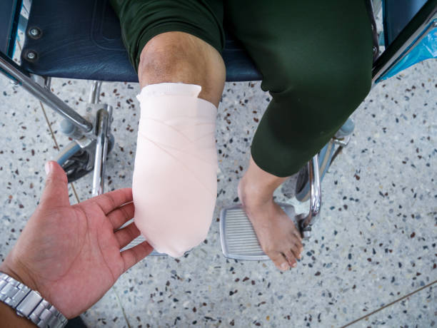 elastic bandaging in diabetes mellitus