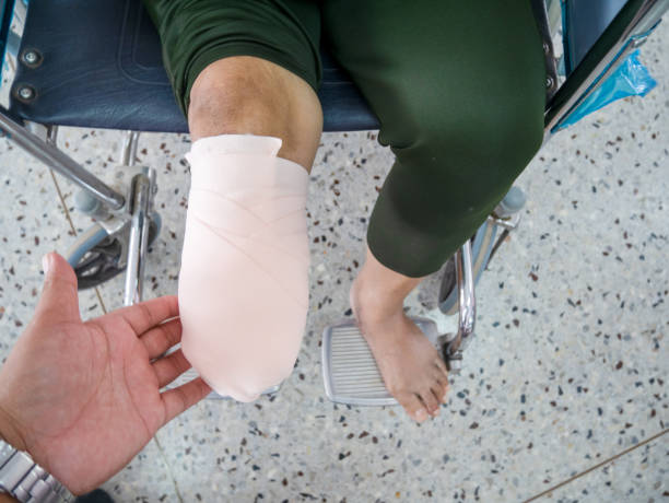 istock elastic bandaging in diabetes mellitus 1174577098