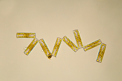 Freshwater diatoms forming a chain. 