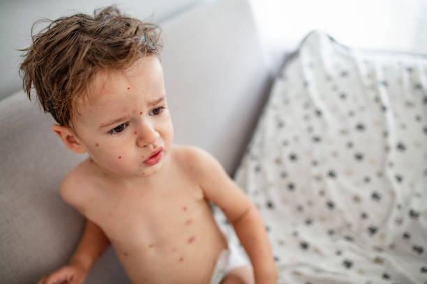 istock Portrait of sick little boy 1174658401