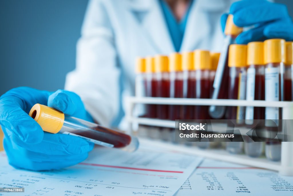 Laborergebnis mit Blutröhren - Lizenzfrei Bluttest Stock-Foto