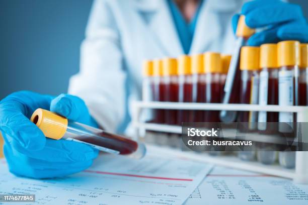 Laborergebnis Mit Blutröhren Stockfoto und mehr Bilder von Bluttest - Bluttest, Blut, Medizinischer Test
