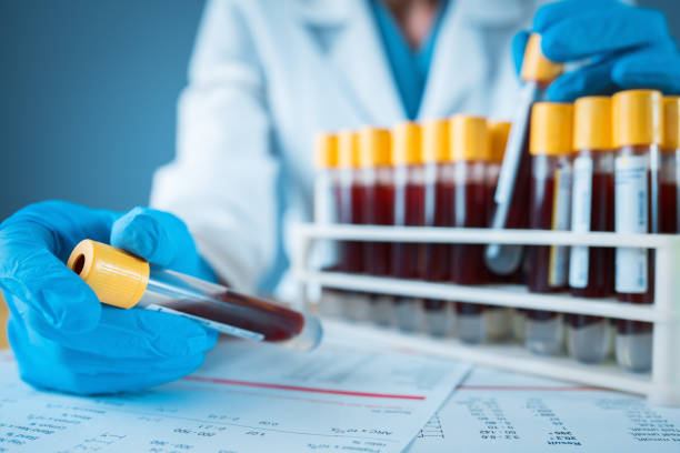 laboratory result with blood tubes - blood imagens e fotografias de stock