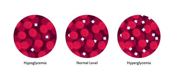 płaska ilustracja niskiego, normalnego i wysokiego poziomu cukru we krwi. - hyperglycemia stock illustrations
