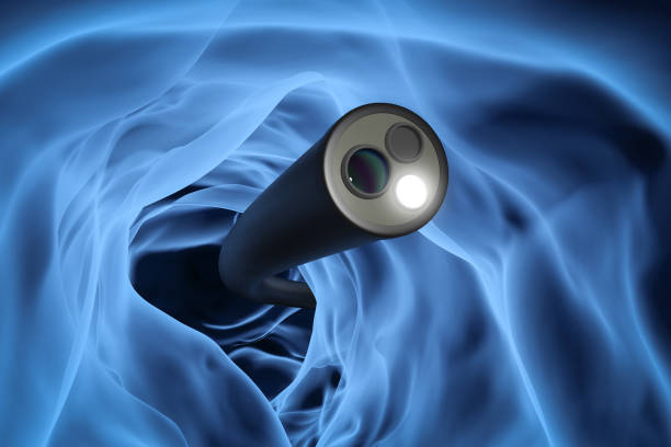 Colonoscopy technology concept Colonoscopy technology concept with 3d rendering x-ray endoscope inside of intestine colonoscopy stock pictures, royalty-free photos & images