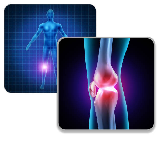 istock Human Knee Joint Pain 1174925356