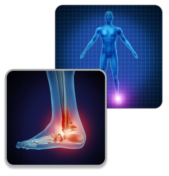 istock Human Foot Joint Pain 1174926080