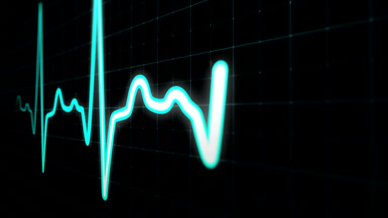 Ecg Machine Animation Cardiac Cycle Animation Ecg