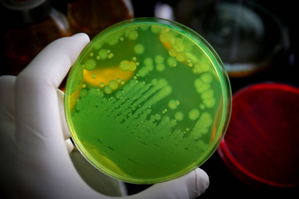 istock Pseudomonas aeruginosa was growth in (selective medium) Cetrimide Agar 1174986049