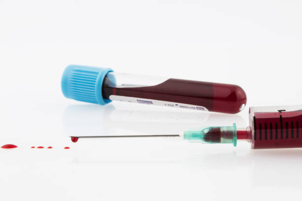 blood tube and syringe blood tube and syringe on the white background with some blood drops medicine and science drop close up studio shot stock pictures, royalty-free photos & images
