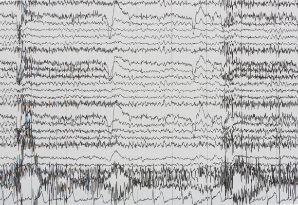 bildgebung der elektroenzephalographie-aufzeichnung von menschen - eeg epilepsy science electrode stock-fotos und bilder