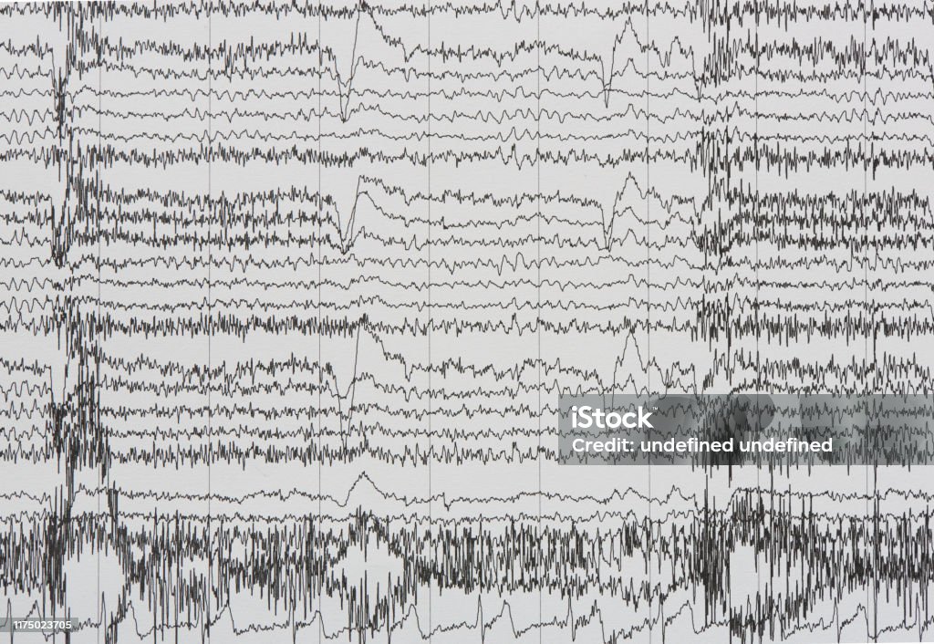 Imaging of electroencephalography recording of human Imaging of brain waves from electroencephalography or EEG in human on the paper EEG Stock Photo