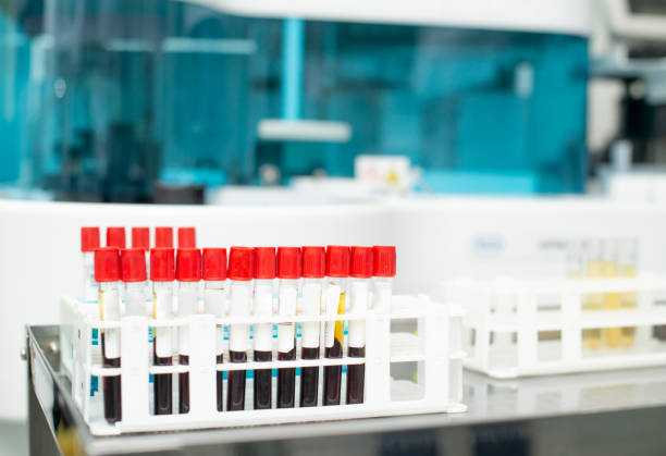 tubes of blood sample for testing - blood bank imagens e fotografias de stock