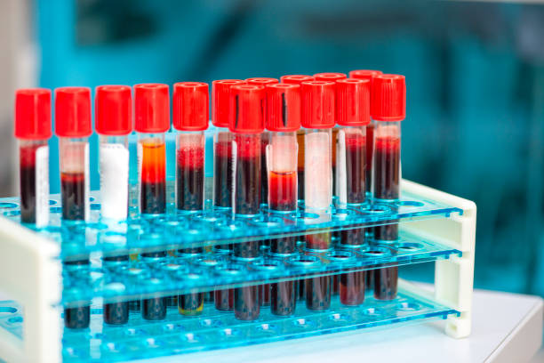 istock Tubes of blood sample for testing 1175042201