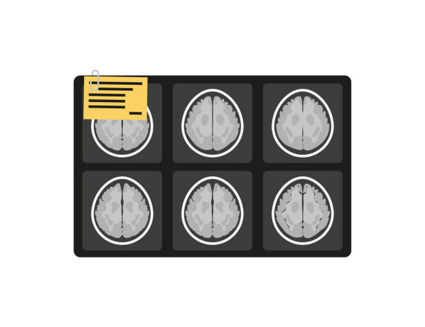 illustrazioni stock, clip art, cartoni animati e icone di tendenza di immagine cerebrale a raggi x mri in stile piatto - doctor brain x ray x ray image
