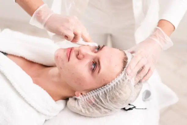 Photo of The doctor removes the gel from the patients face and apply a therapeutic cream. Anti acne phototherapy. Beautiful woman during photo rejuvenation procedure. Face skin treatment at cosmetic clinic.