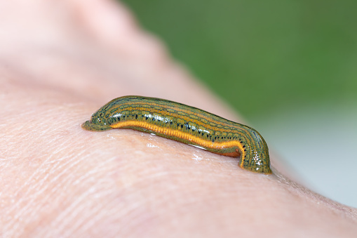Aquatic Leech Sucking Blood On Skinleeches Were Used In Medicine From  Ancient Stock Photo - Download Image Now - iStock