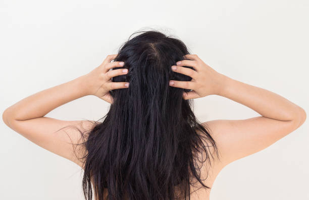 istock Woman suffering from itching her head, Itching scalp. 1175509634