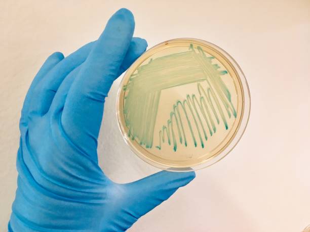 istock Petri dish with blue bacterial colonies, handle by a technician 1175521753