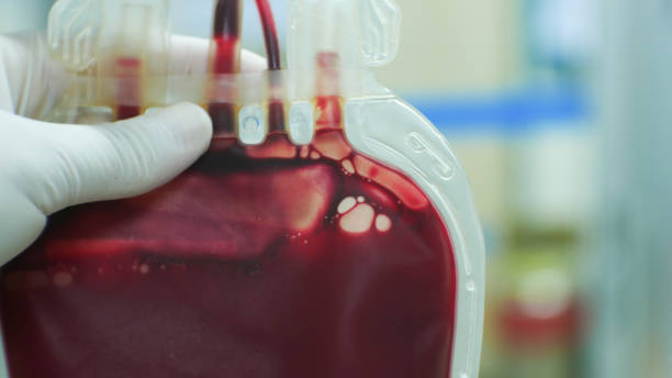 red blood on blood bag in laboratory.blood donation concept. - blood bank imagens e fotografias de stock