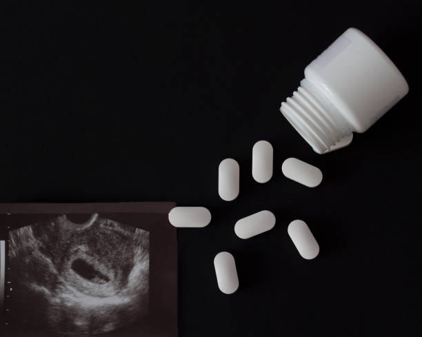uno scatto di una gravidanza uzi e pillole con un barattolo, uno sfondo nero - aborto foto e immagini stock