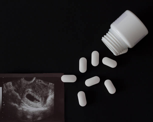 A shot of a uzi pregnancy and pills with a jar, a black background A shot of a uzi pregnancy and pills with a jar, a black background abortion stock pictures, royalty-free photos & images