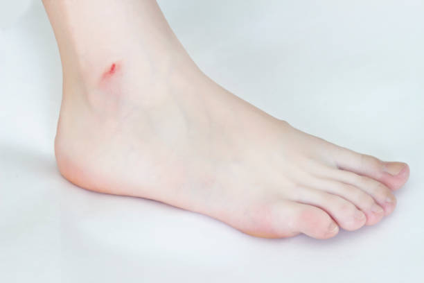 female leg on white background, cut after shaving legs - plucking machine imagens e fotografias de stock