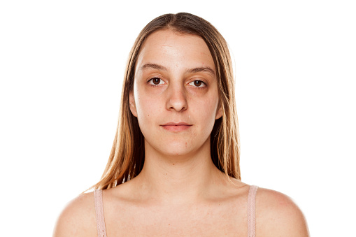 Young woman without makeup on white background