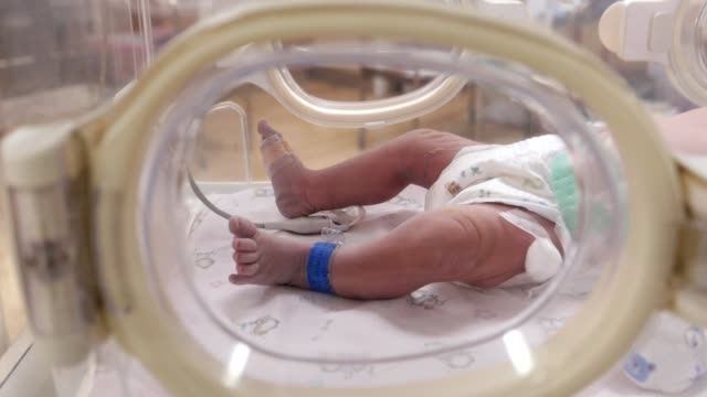 CU : Infant baby feet moving with medical devices