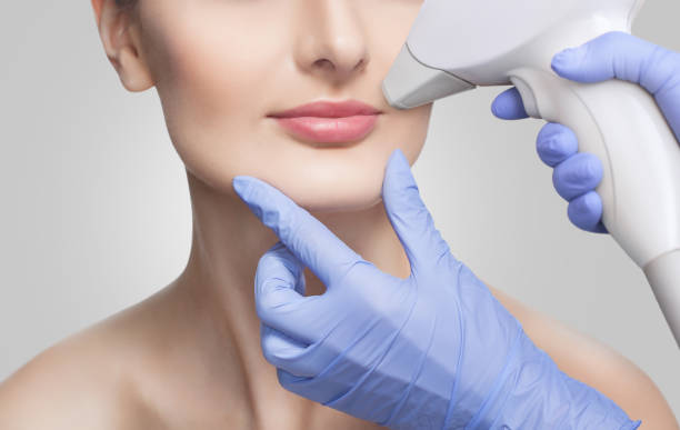 The cosmetologist does the procedure for laser hair removal of unwanted hair of the face to a young girl in a beauty salon. The cosmetologist does the procedure for laser hair removal of unwanted hair of the face to a young girl in a beauty salon. woman hairline stock pictures, royalty-free photos & images