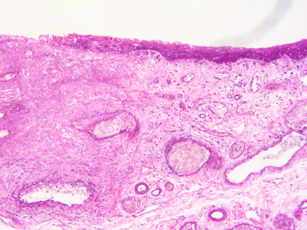 istock histology of human tissue 1175905832