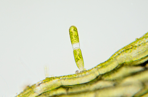 Micrograph of young filament of algae, Oedogonium species, attached to another plant. Wet mount, 40X objective, transmitted brightfield illumination. Note - very shallow depth of field, chromatic aberration and uneven focus are inherent in light microscopy.
