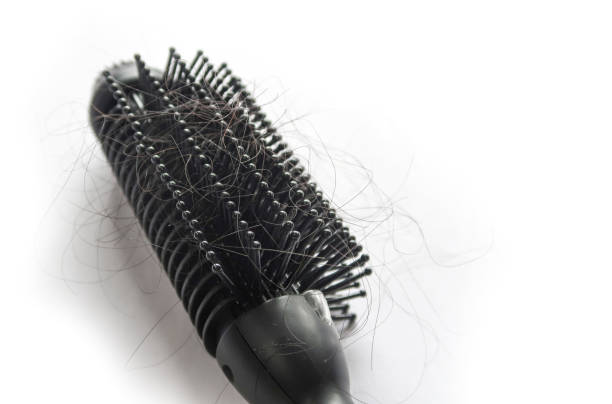 istock Hair fall in hairbrush with copy space 1176048905