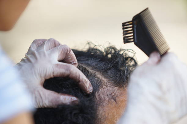 istock Woman dyeing hair 1176111879