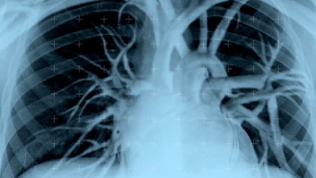 Live X-Ray Image of Human Torso