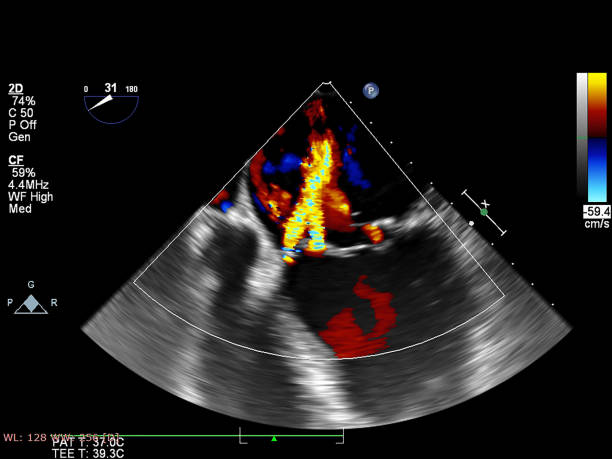 pantalla de la máquina de ecocardiografía (ultrasonido). - the vomiting of blood fotografías e imágenes de stock