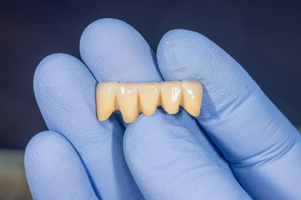 istock ceramic crowns of human teeth closeup macro isolate on black background. The concept of aesthetic dentistry 1176647580