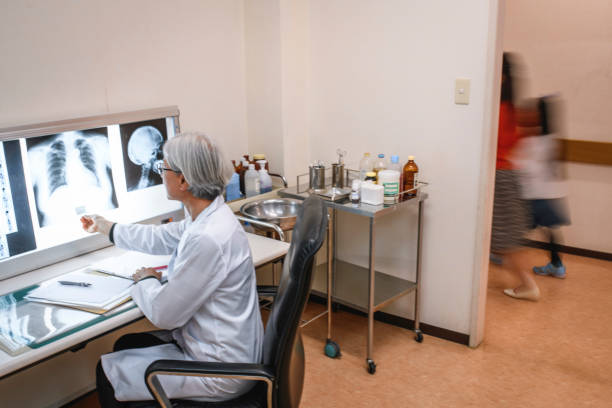 라이트 박스에서 엑스레이를 검사하는 선임 여성 일본 의사 - 3670 뉴스 사진 이미지