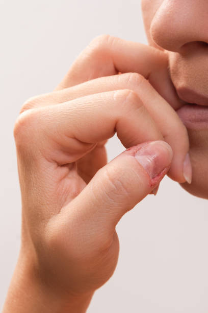 istock Woman bitting her fingers 1176745257
