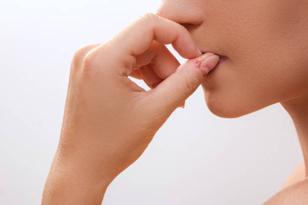 woman bitting her fingers - nail biting imagens e fotografias de stock