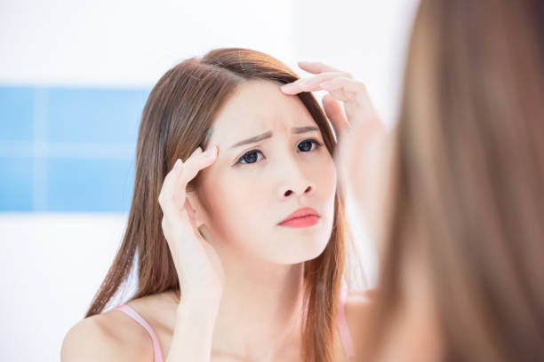 istock woman worry forehead wrinkles 1176798691