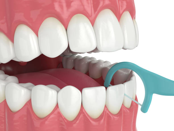 istock 3d render of jaw with dental floss toothpick 1176973975