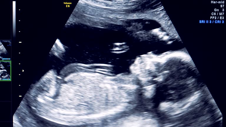10,800+ Pregnant Belly Moving Stock Videos and Royalty-Free Footage