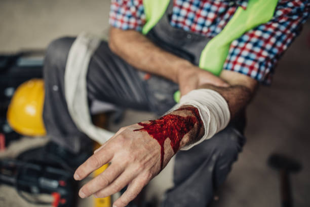 建設作業員の身��体的傷害 - falling ladder physical injury accident ストックフォトと画像