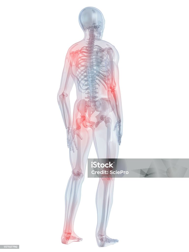 inflammated articulaciones - Foto de stock de Anatomía libre de derechos