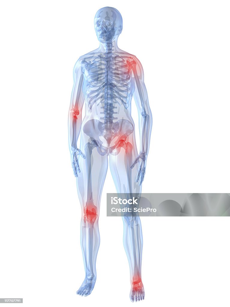 inflammated articulaciones - Foto de stock de Anatomía libre de derechos