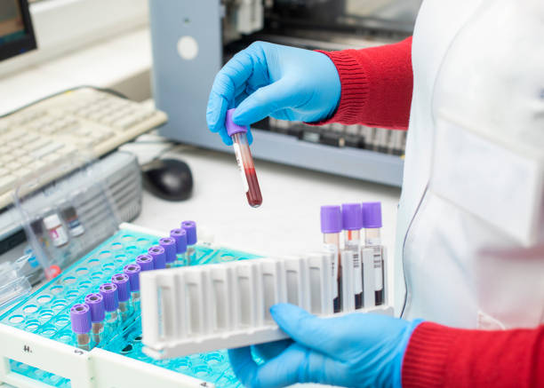 医師の手は、ラボの背景に分析の機械とラックから血液サンプルチューブを取って/研究室での血液管のテストを保持する技術者 - vial laboratory test tube biotechnology ストックフォトと画像